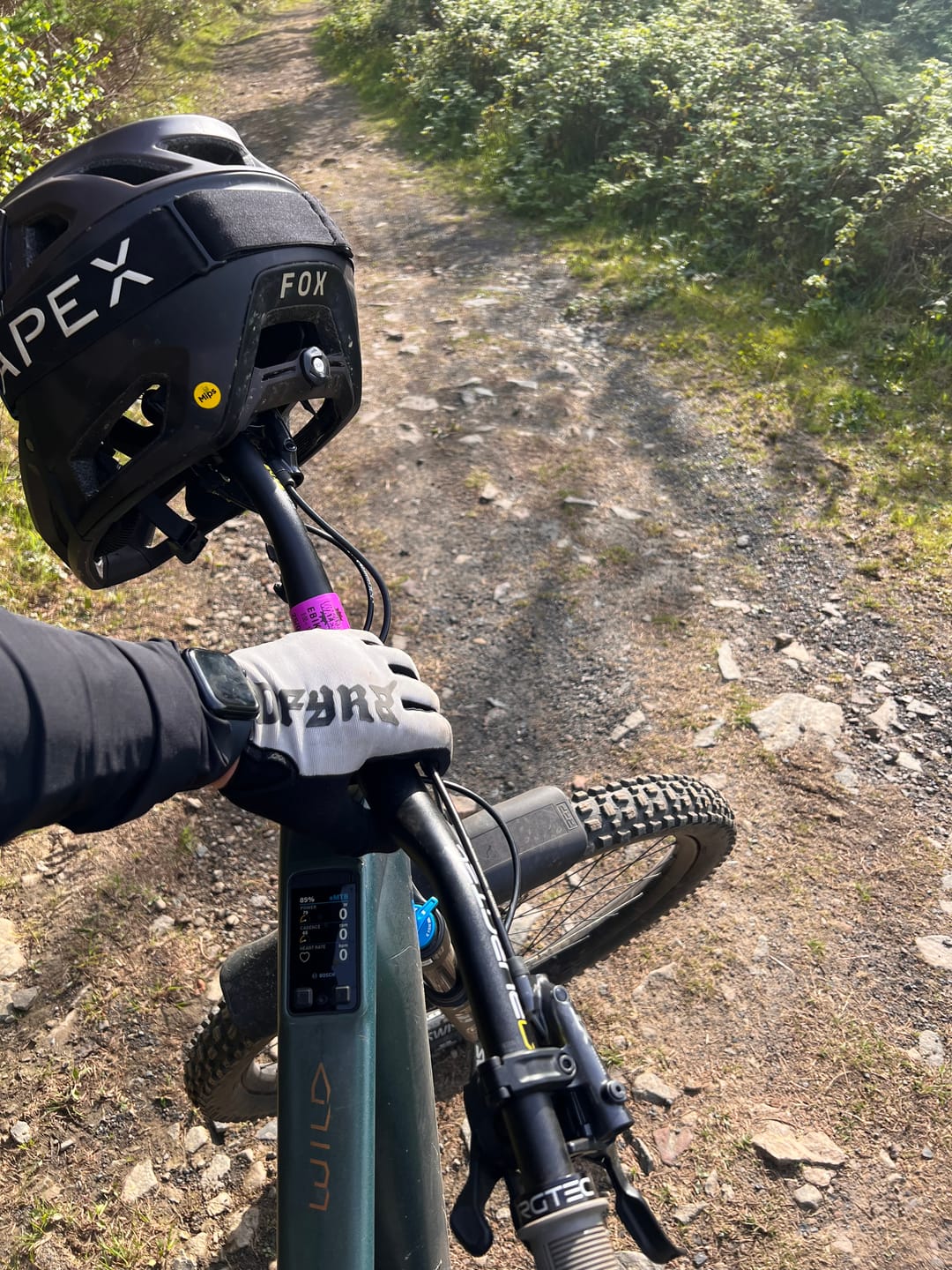 Customer photo review of Lucky Dip | Compression Shred Socks