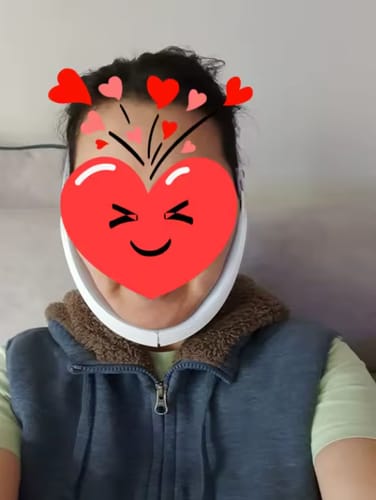 Customer photo review of ALISSEA V-SCULPT™  Dispositivo lifting facial EMS- LED tecnology