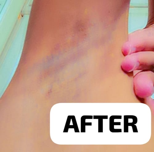Customer photo review of Bright Skin Bish