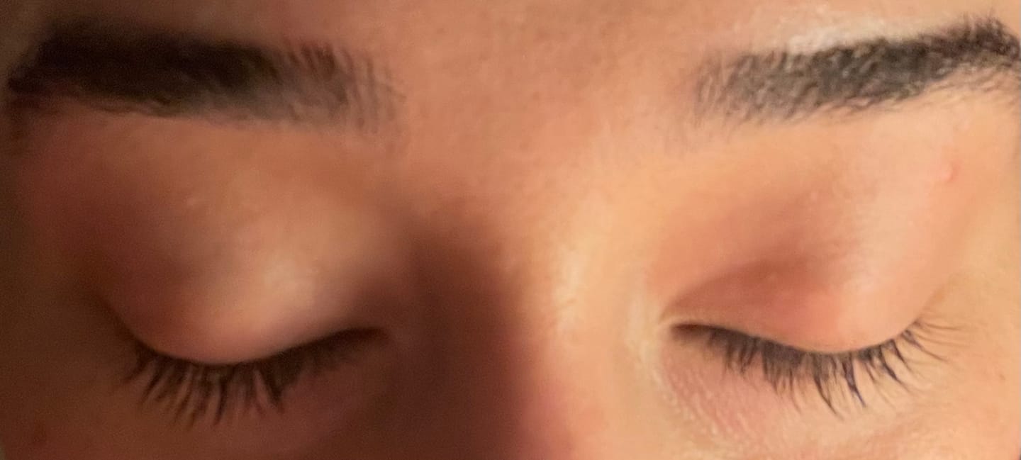 Customer photo review of NEW & IMPROVED LASH SERUM