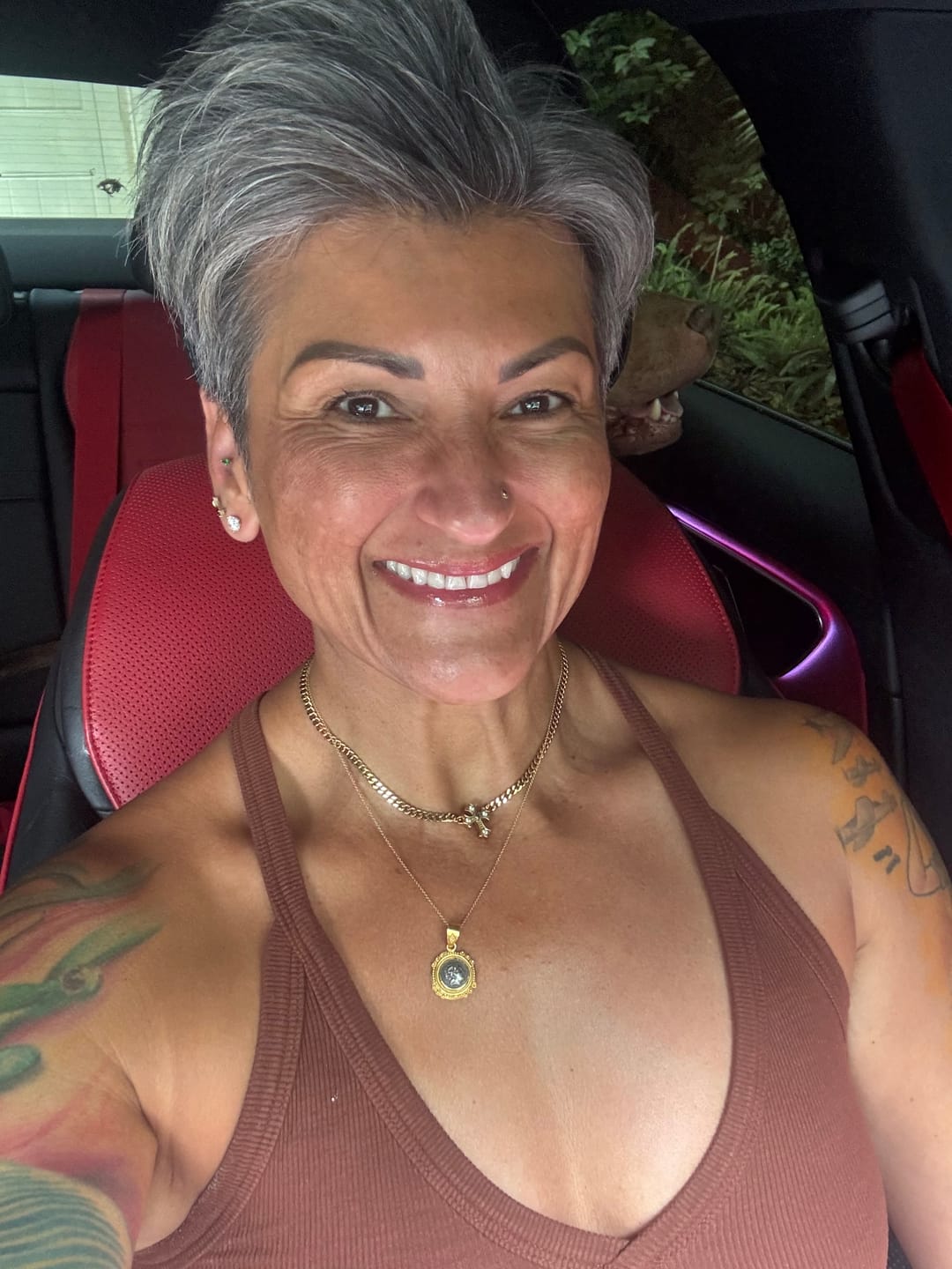 Customer photo review of 3 Month Supply - Seranova Micro Infusion System