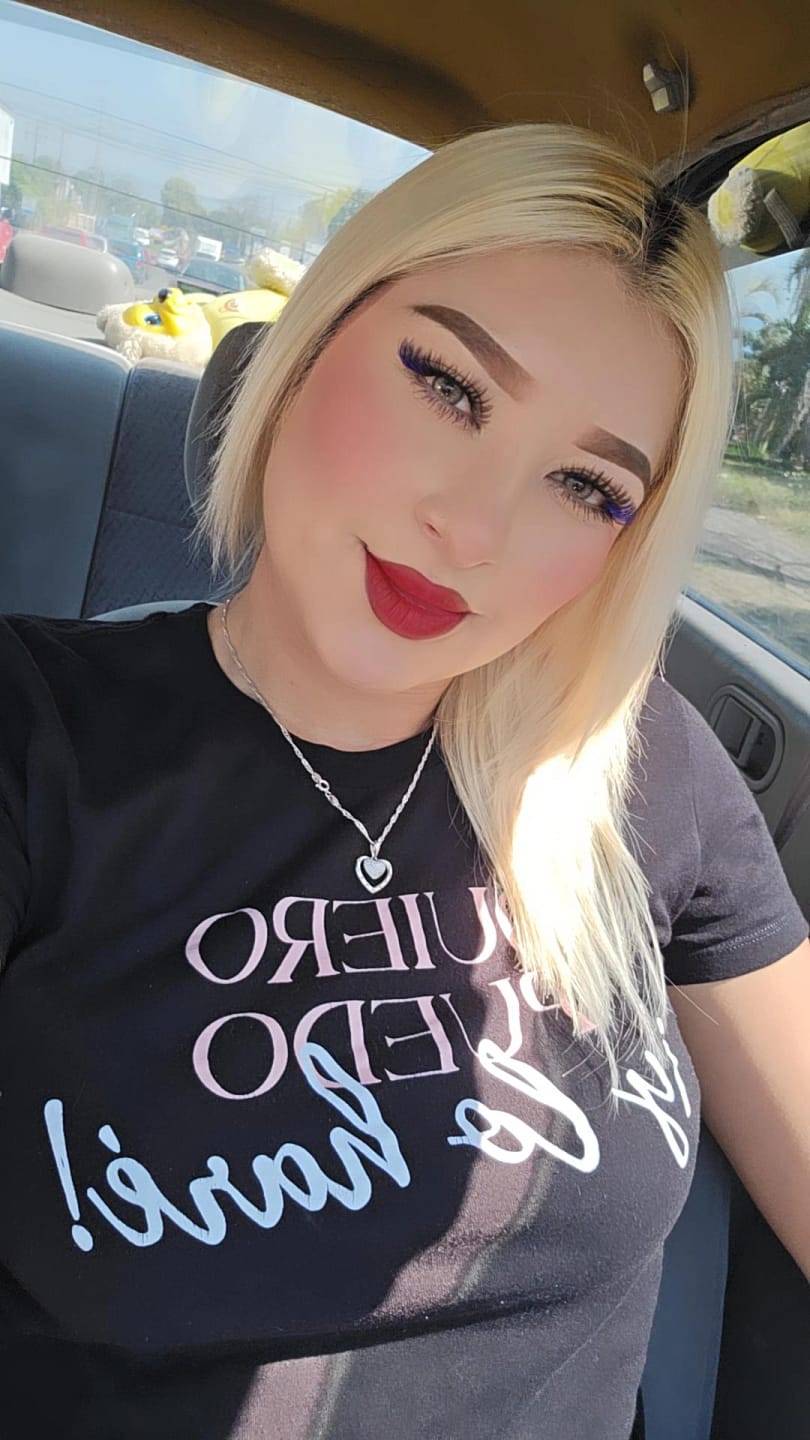 Customer photo review of Citha Hazel Brown Prescription Colored Contact Lenses