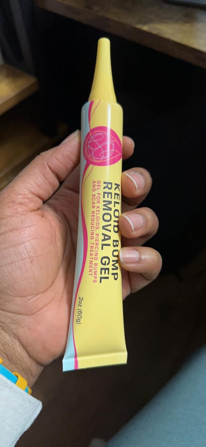 Customer photo review of Keloid Bump Removal Gel