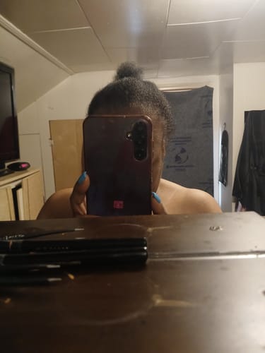 Reviewer showing hair growth progress at their hairline after using Rennora Hair Growth Serum for one month.