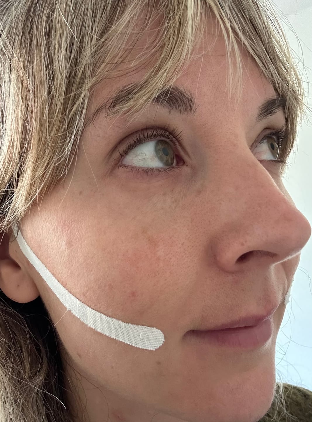 Customer photo review of Zygo Tape - Facial Sculpting & Anti-Aging Tape For Women