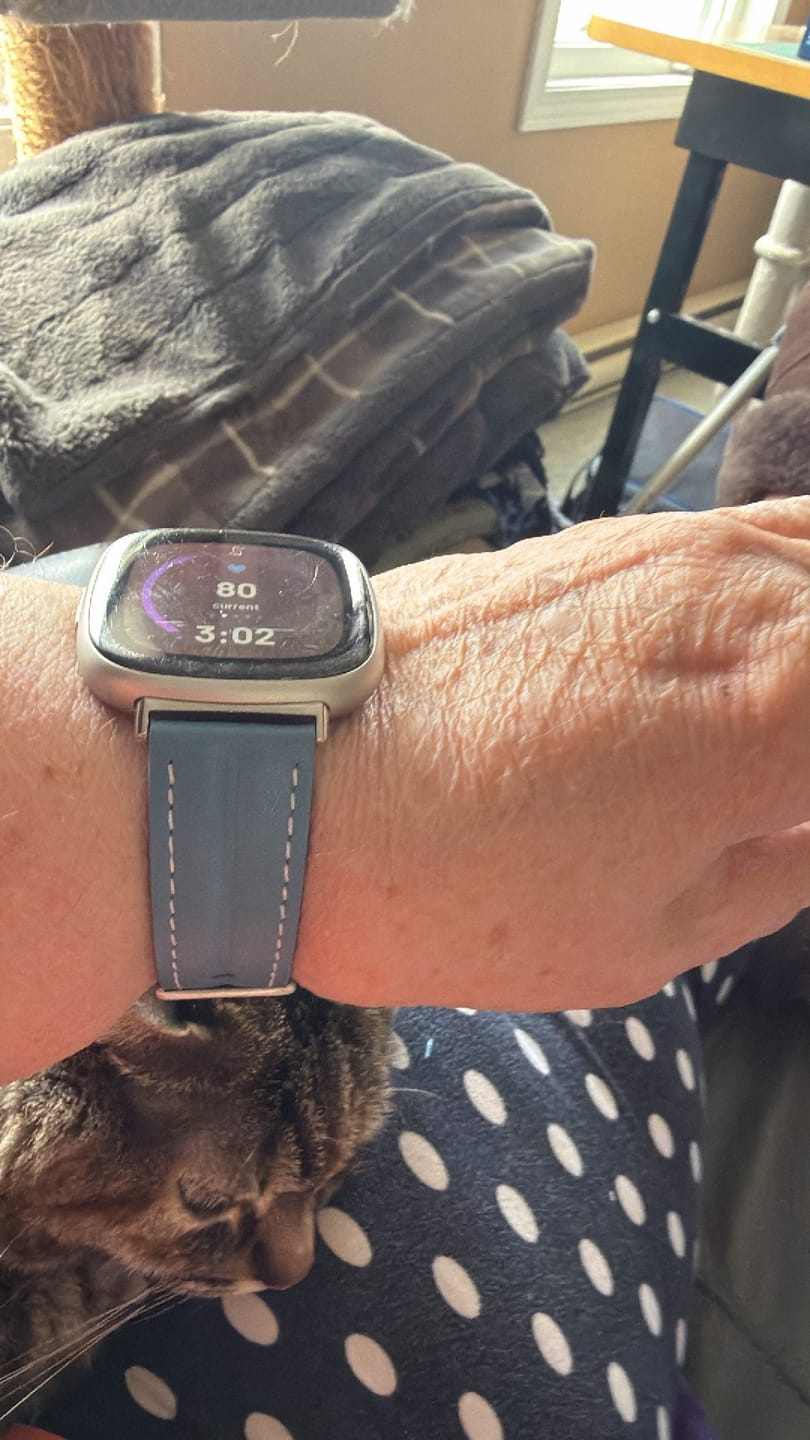 Customer photo review of Fitbit Versa & Sense Leather Band - Premium Comfort
