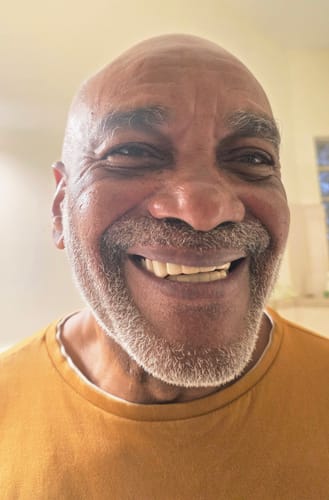 Customer smiling broadly, showing a perfect set of Pop On Veneers.