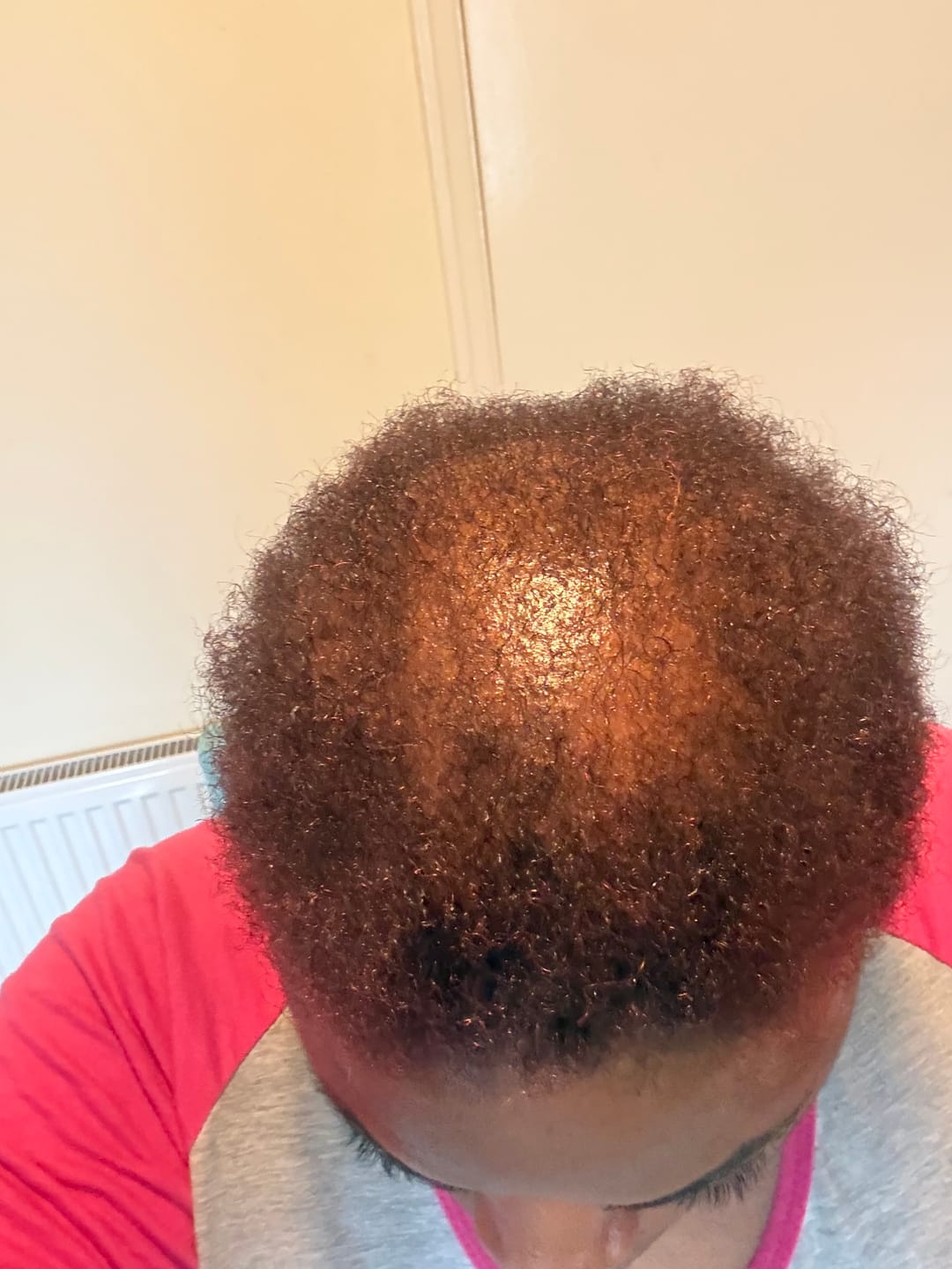 Customer photo review of Healthy Hair Starter Kit- Limited Edition