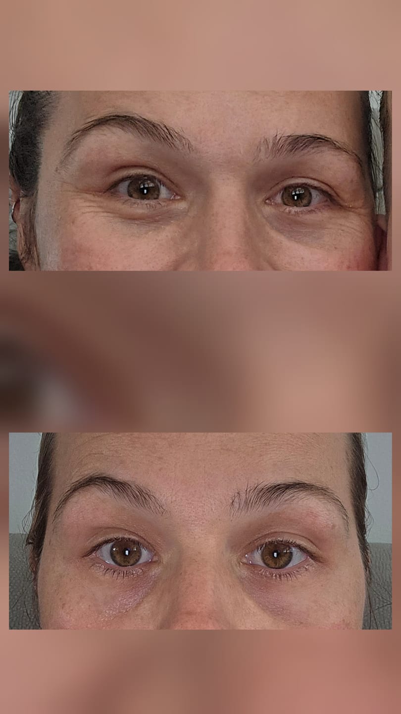 Customer photo review of BRIGHT & TIGHT UNDER EYE CREAM