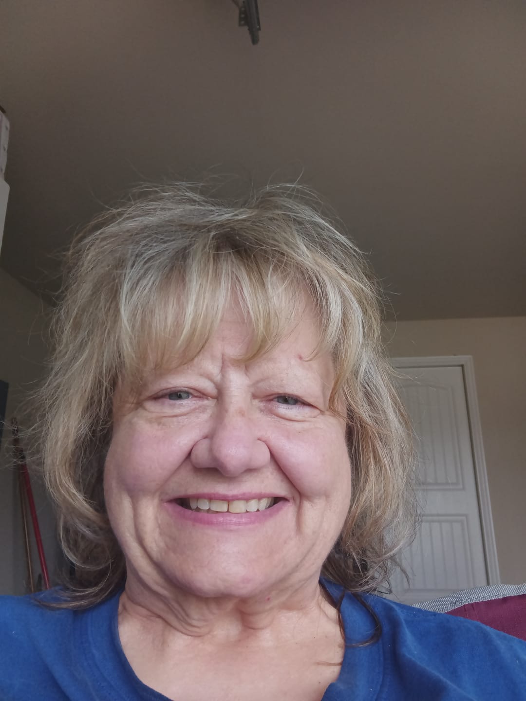 Customer photo review of Hair Growth Hero Bundle