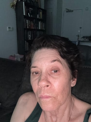 Reviewer shows their bright, supple skin after using the Seranova Micro Infusion System.