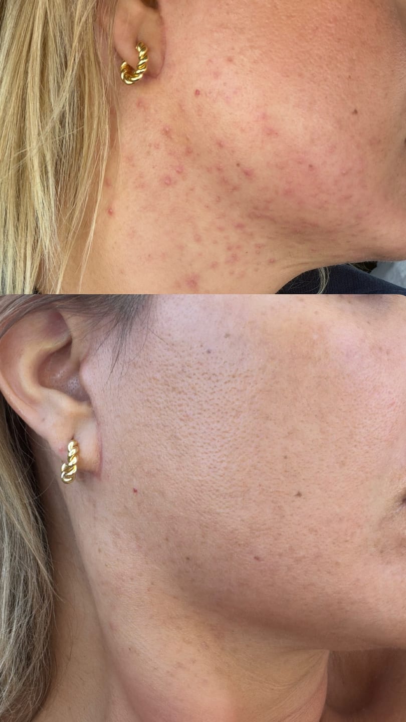 Customer photo review of LAVISH CREAM | RICH HYDRATION