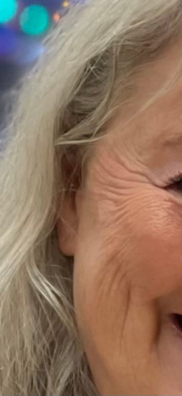 Customer photo review of Koriderm™ Time Reverse Cream (All-In-One)