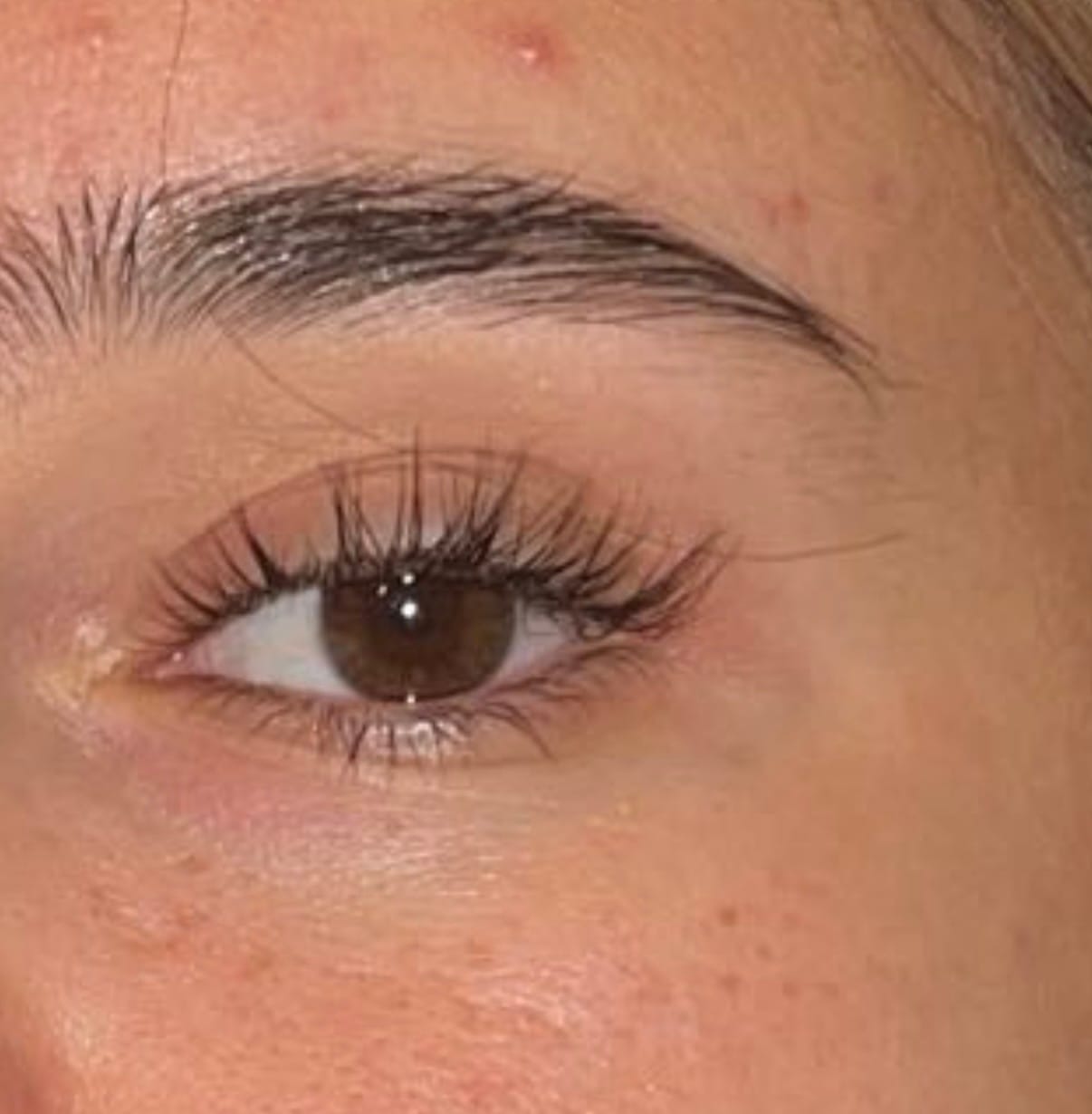 Customer photo review of Sérum auralash
