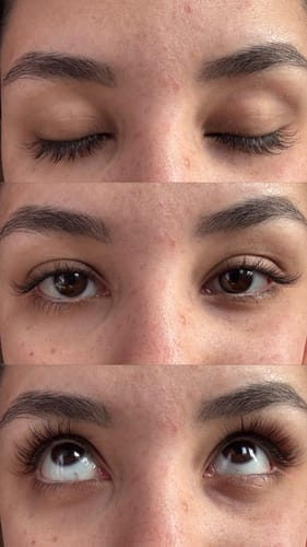 Customer photo review of KosmaLash® | Sérum Crecimiento & Anticaída