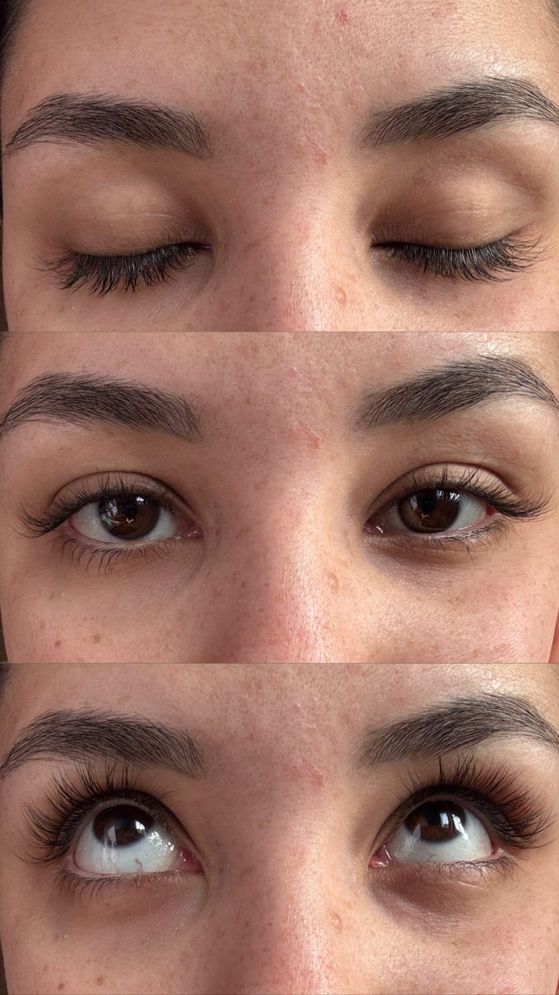 Customer photo review of KosmaLash® | Sérum Crecimiento & Anticaída