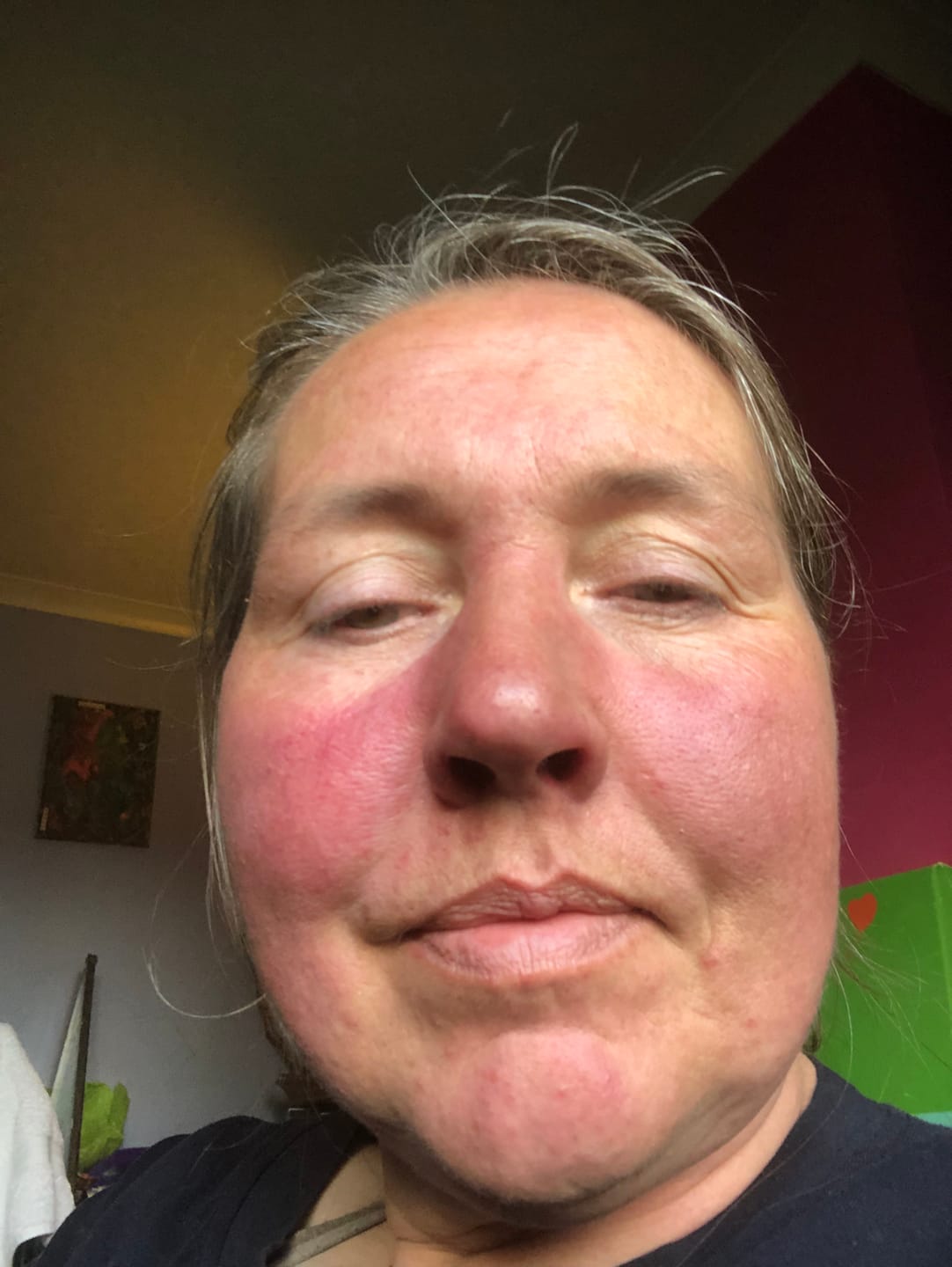 Customer photo review of Rosalique 3 in 1 Anti-Redness Miracle Formula SPF50