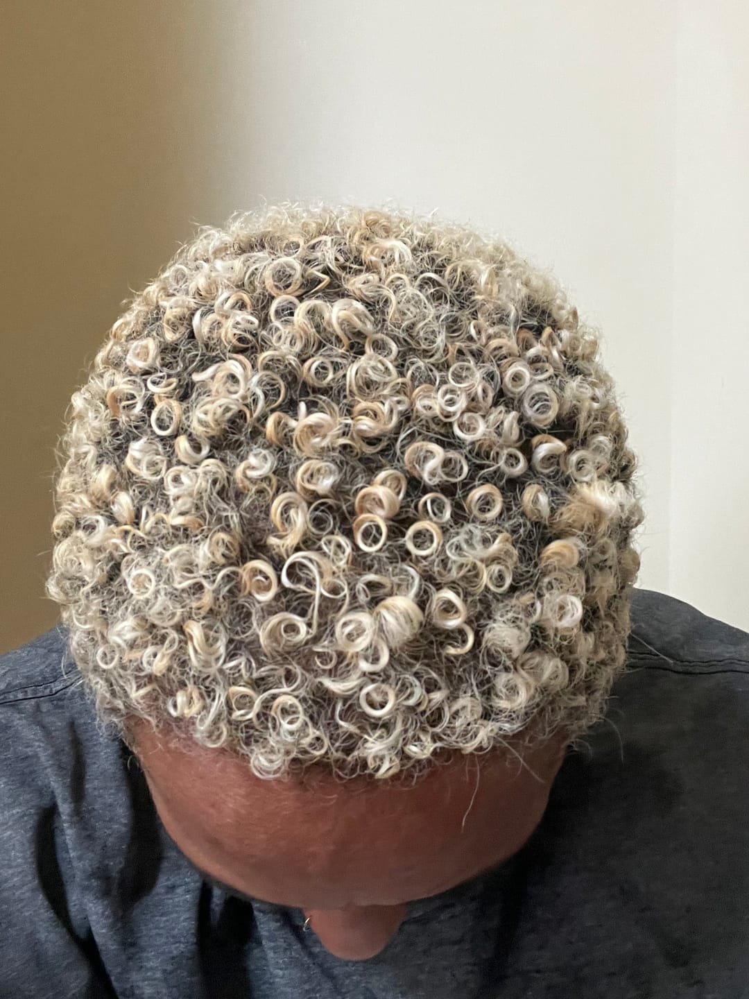 Customer photo review of Scalp Stimulator | Hair Growth Oil