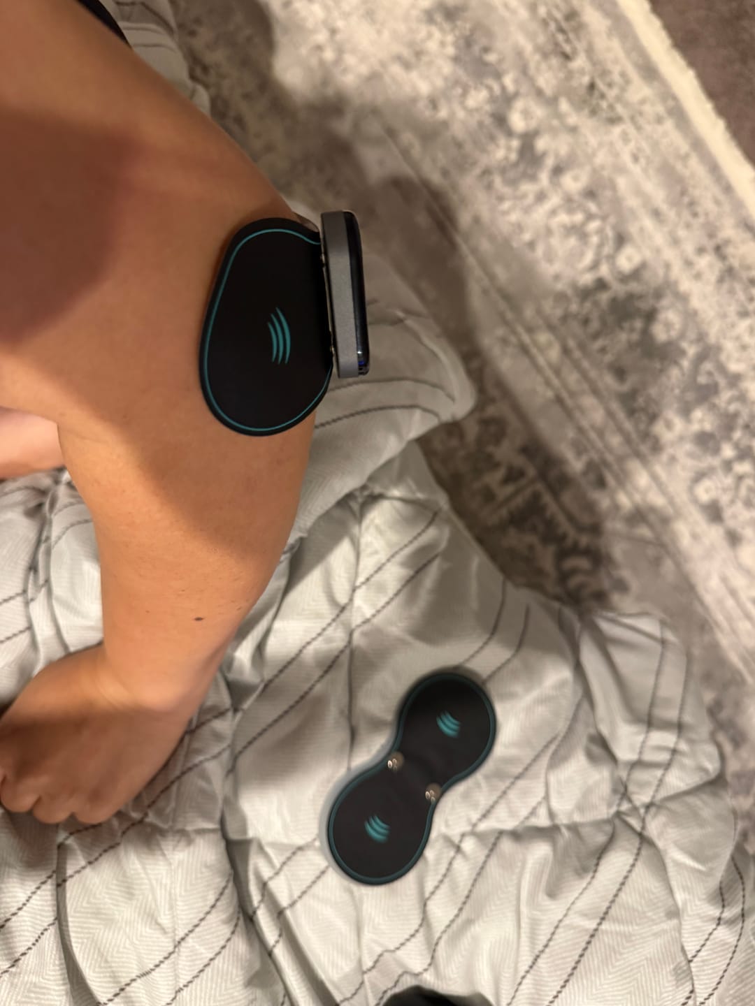 Customer photo review of Vibit Pulse - Wireless Electrical Muscle Stimulator