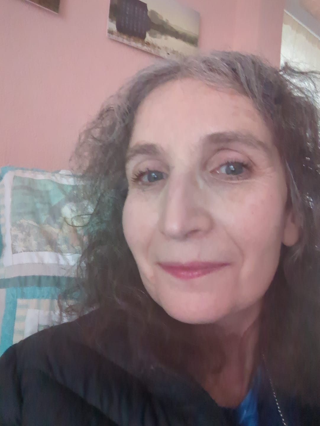 Customer photo review of Herbal Psoriasis Relief Cream
