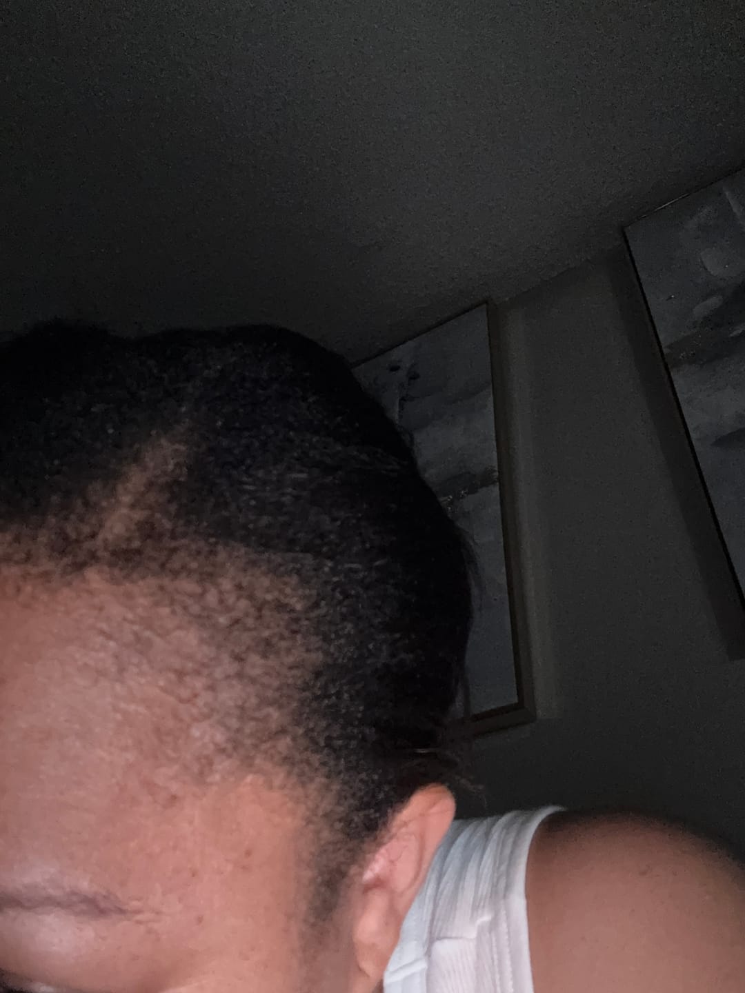 Customer photo review of Ultimate Hair Growth Bundle