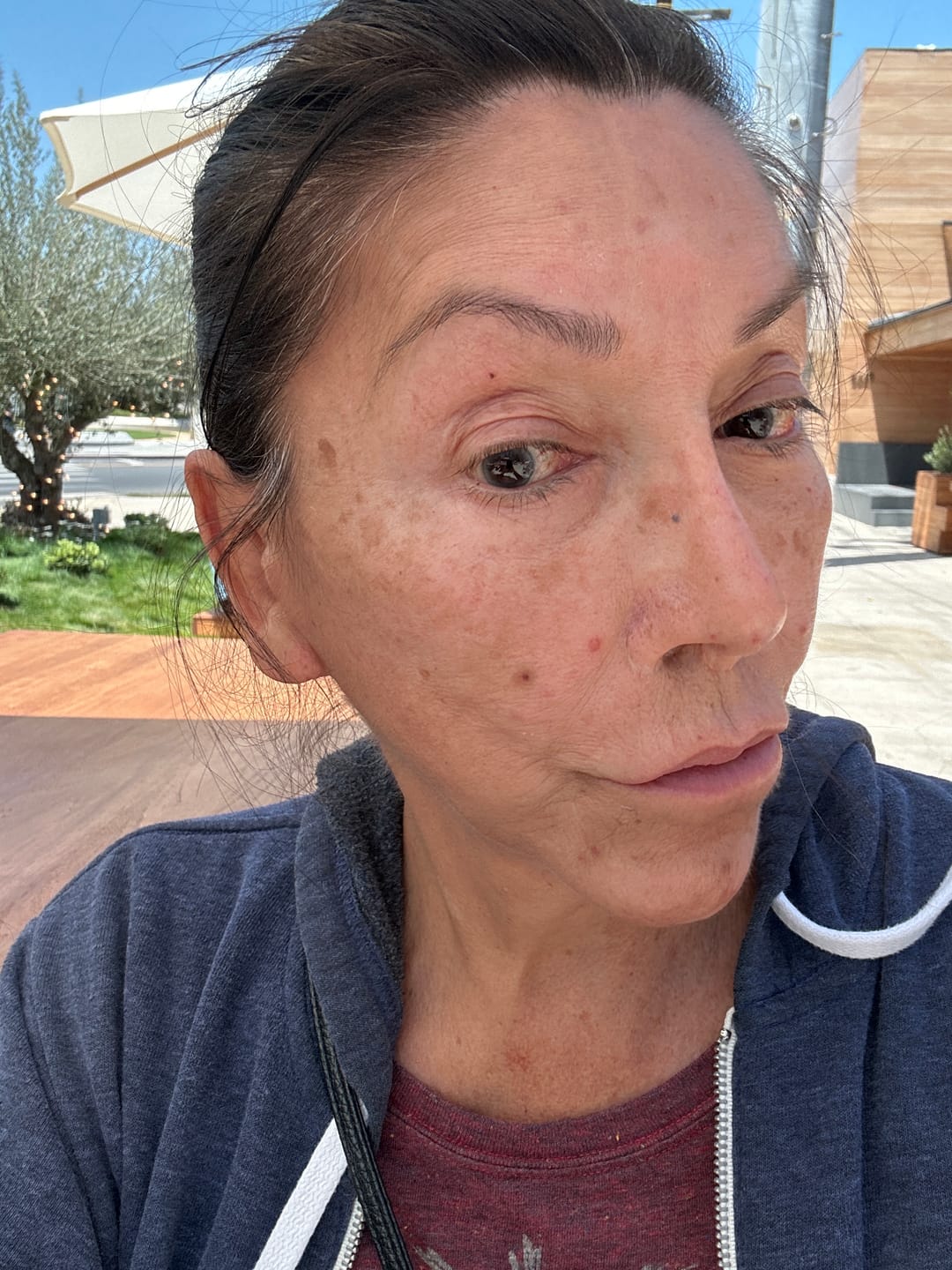 Customer photo review of Zygo Tape - Facial Sculpting & Anti-Aging Tape