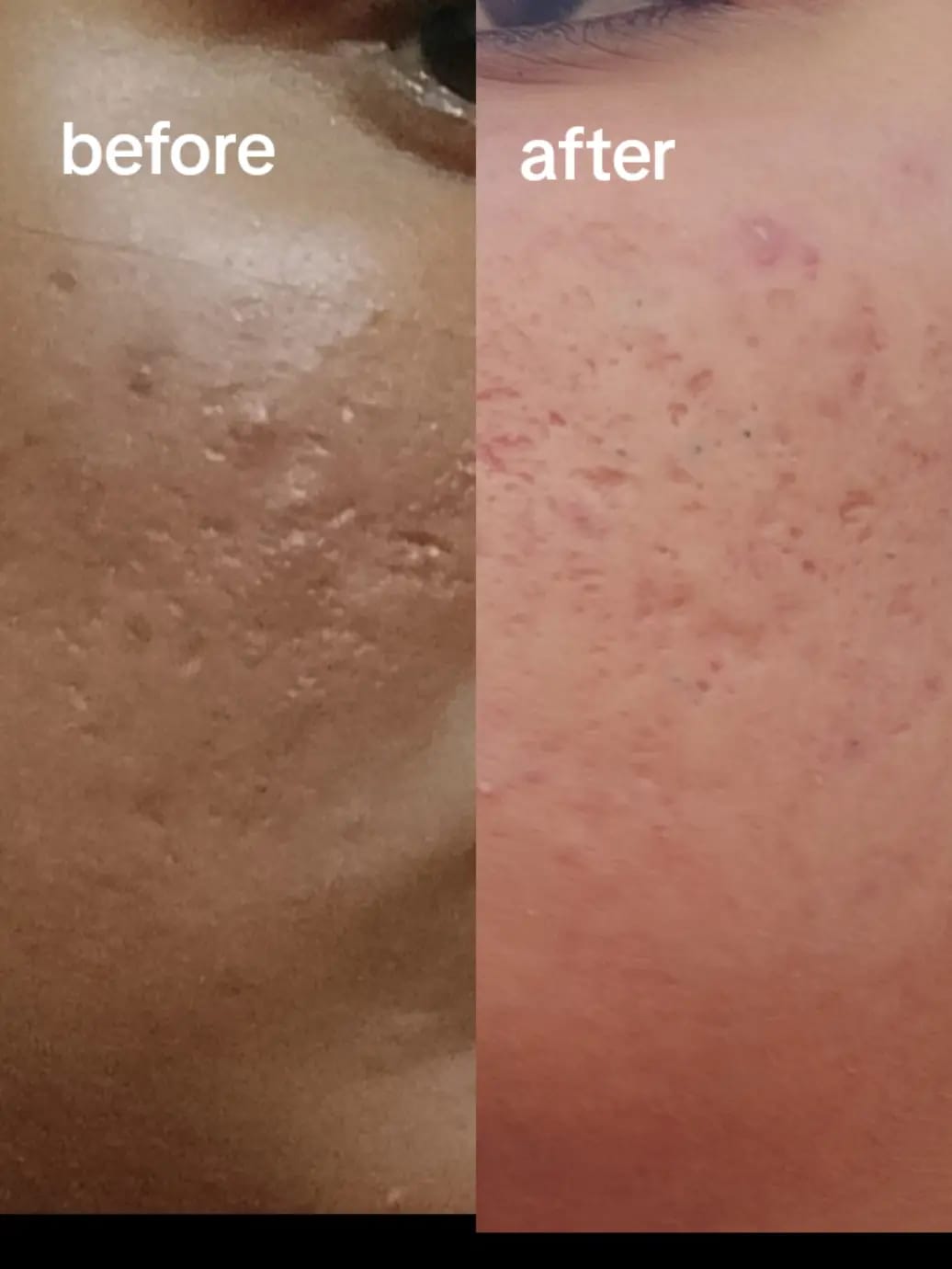 Customer photo review of Maxdif Brightening Cream