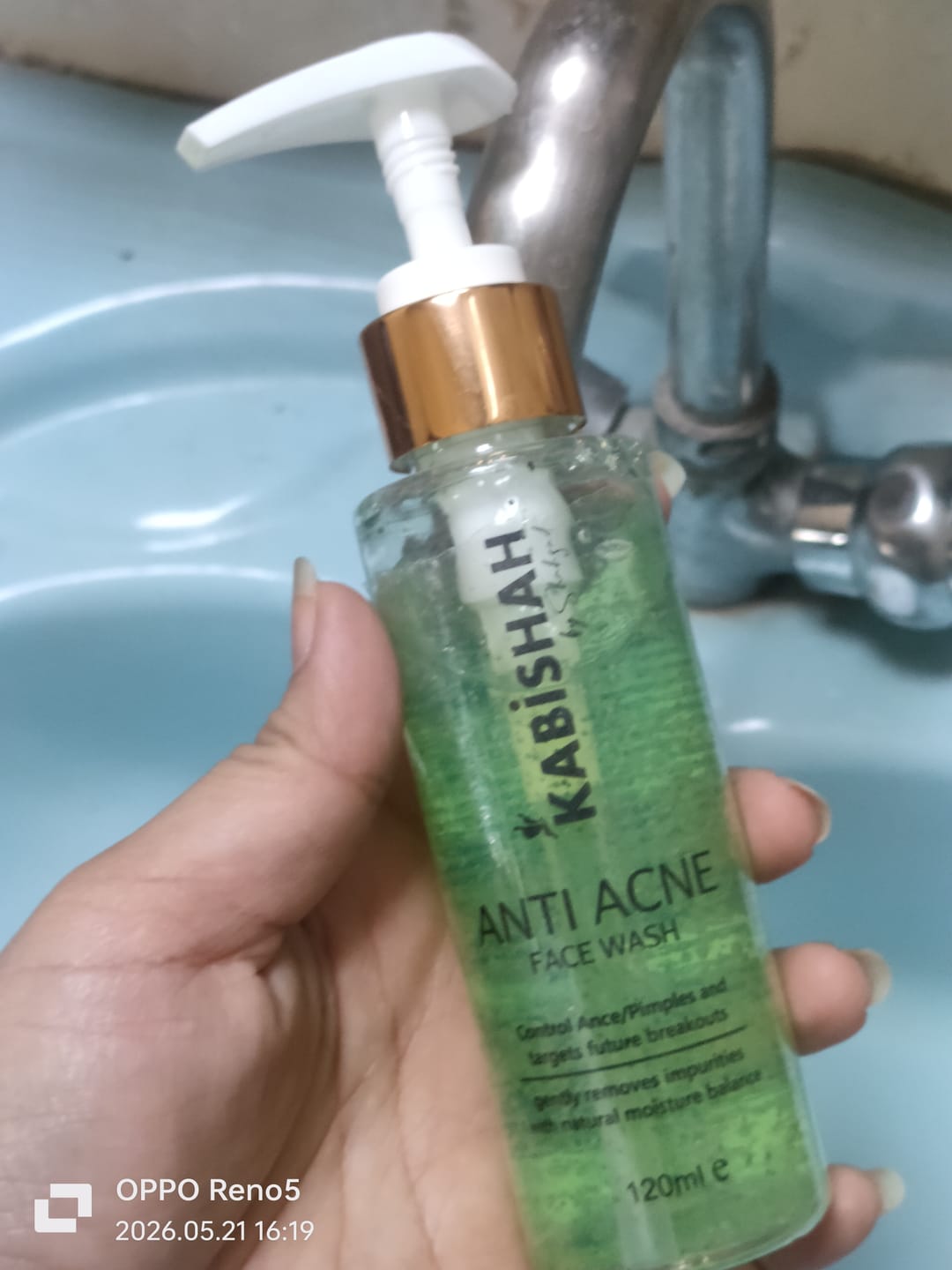 Customer photo review of Anti Acne Facewash 150ml