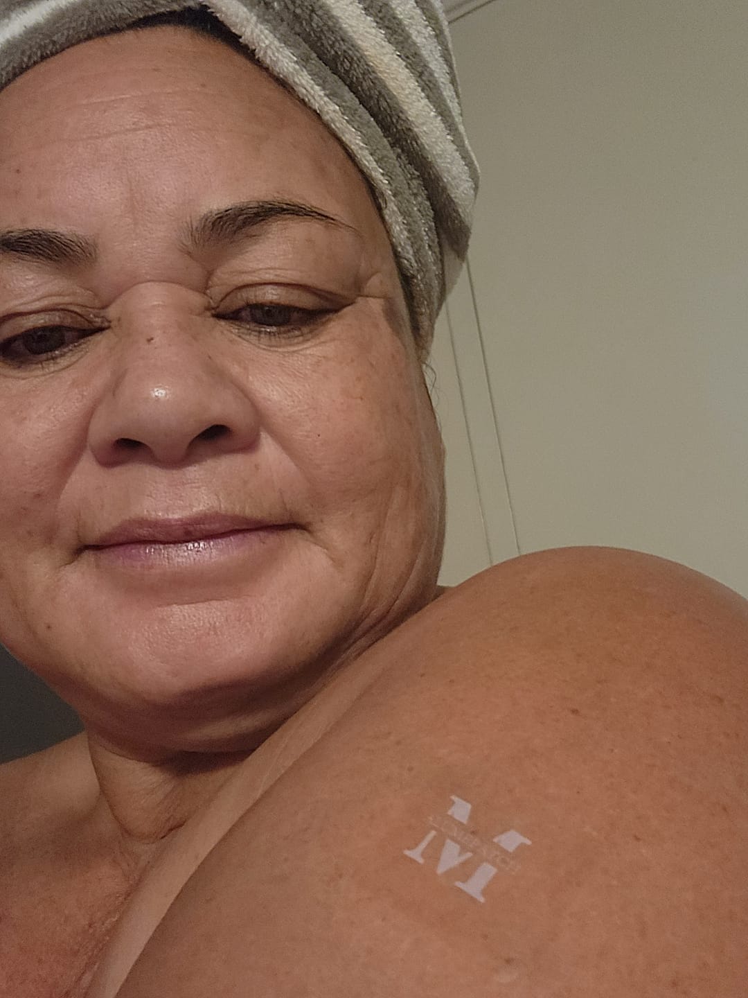 Customer photo review of alumepatch Menopause Patch