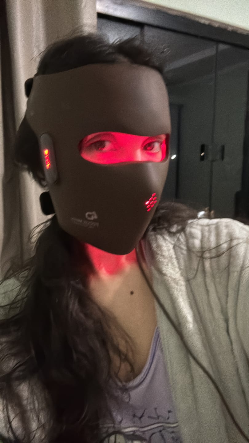 Customer photo review of JOVS 4D Laser Anti-Aging Therapy Mask
