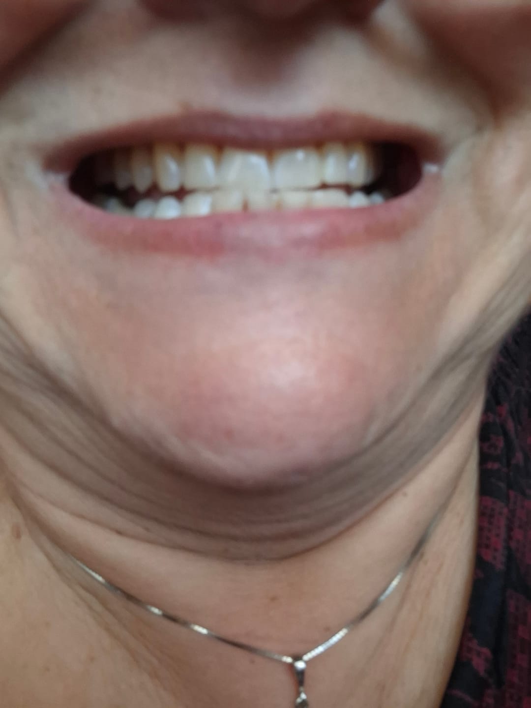 Customer photo review of Dentlux ochucená zubní pasta Jahoda