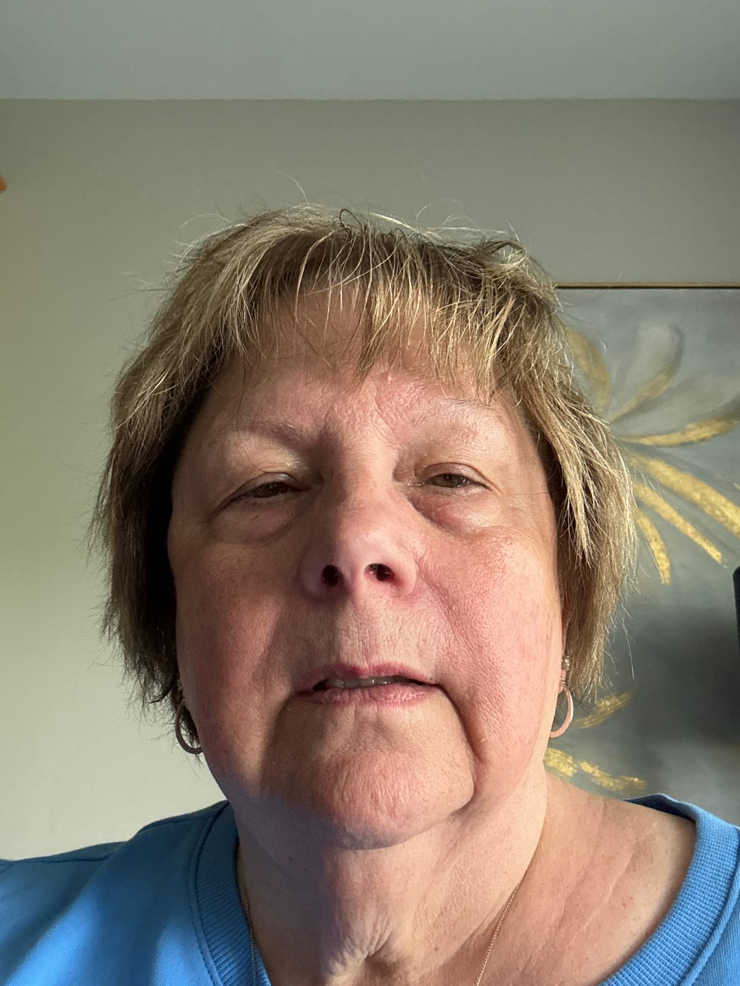 Customer photo review of Micro Infusion Patches