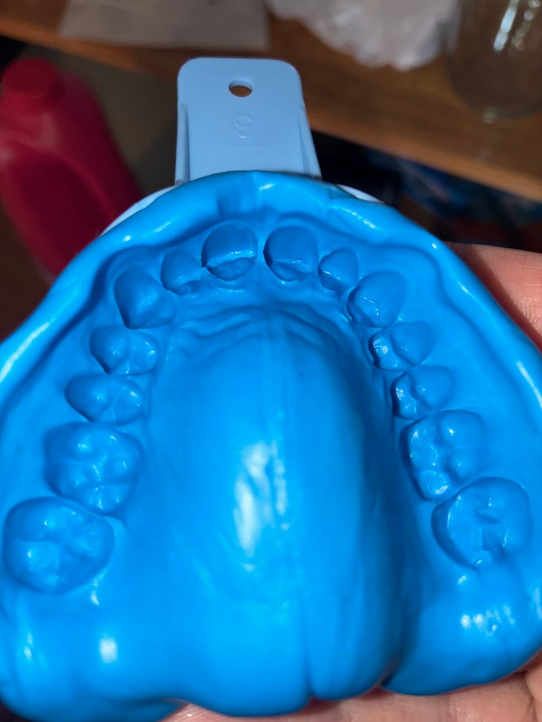 Customer photo review of Clear Custom Night Guard
