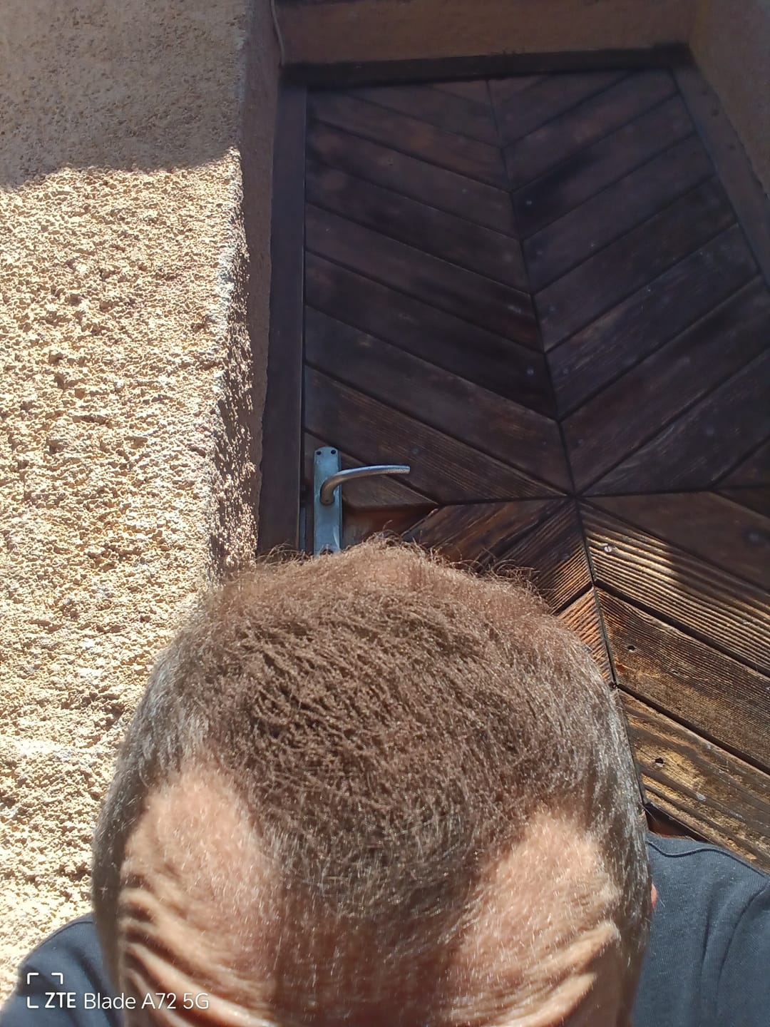 Customer photo review of Fibre copri Calvizie da 12gr | Castano Chiaro | 30 Giorni di applicazioni