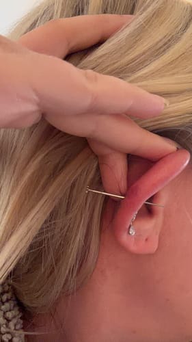 Close-up of a reviewer guiding the Flatback Insertion Taper through a cartilage piercing.