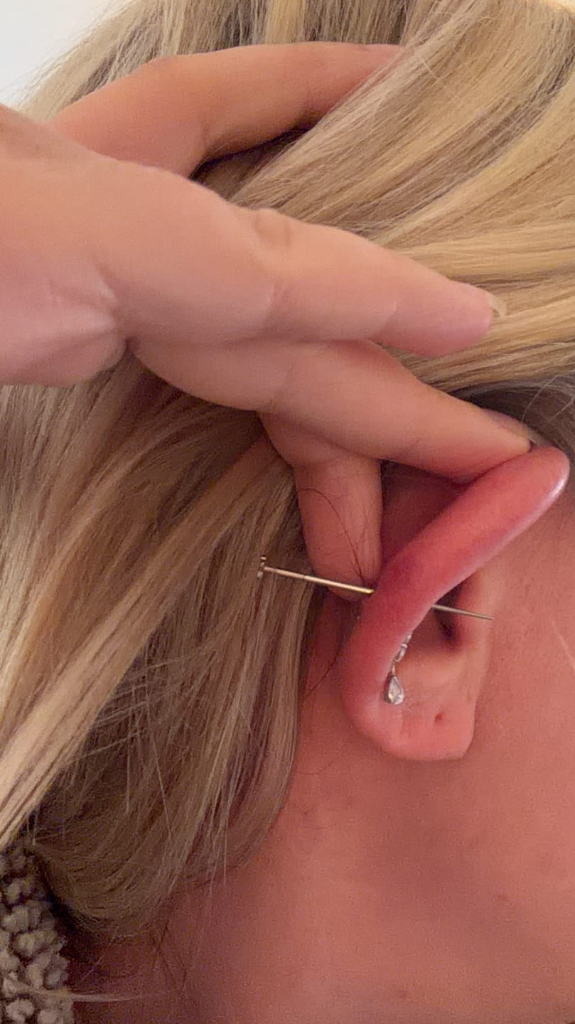 Customer photo review of Flatback Insertion Taper