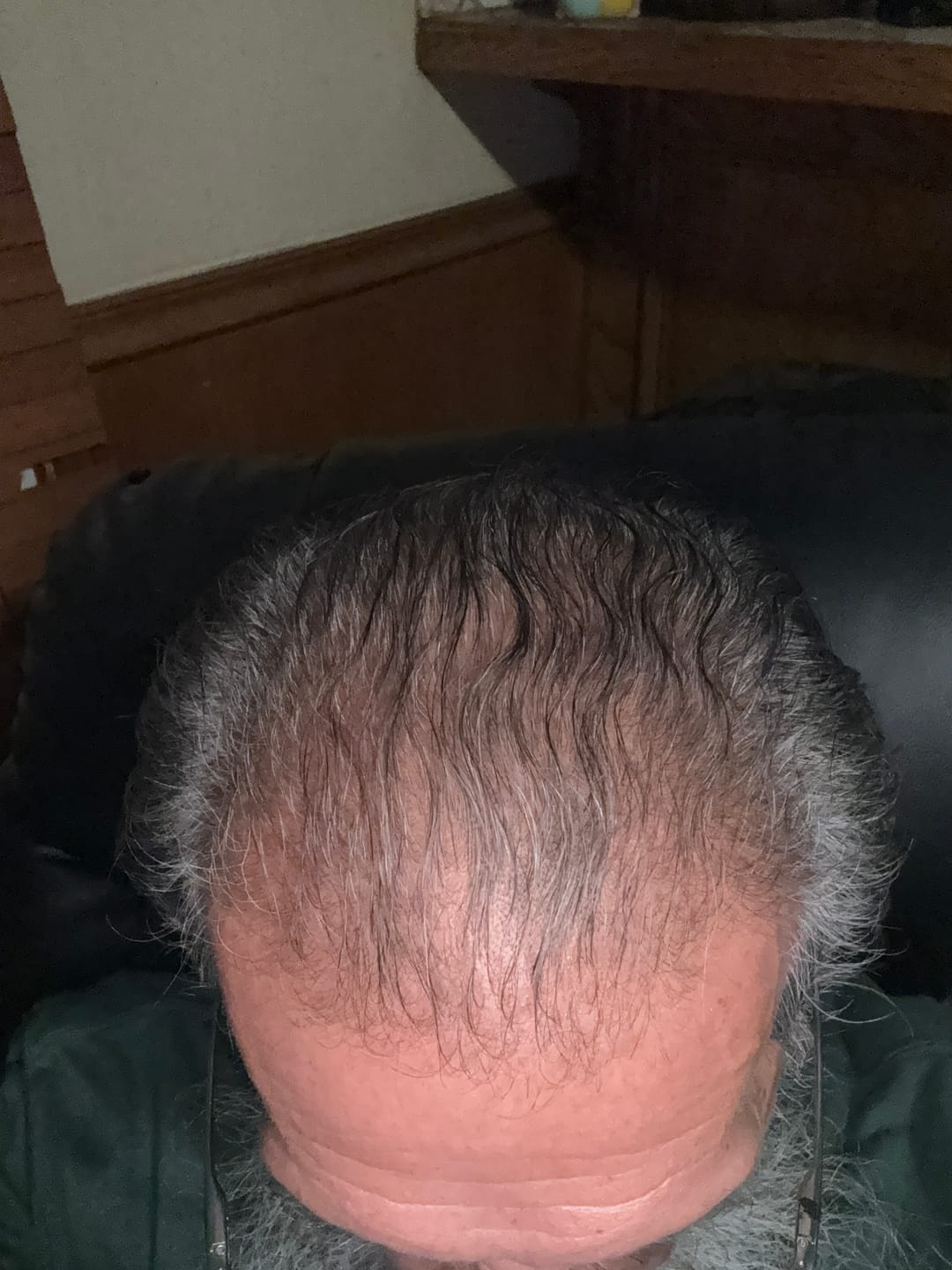 Customer photo review of Spartan™ Root Activator Shampoo 3 Bottles(sc)