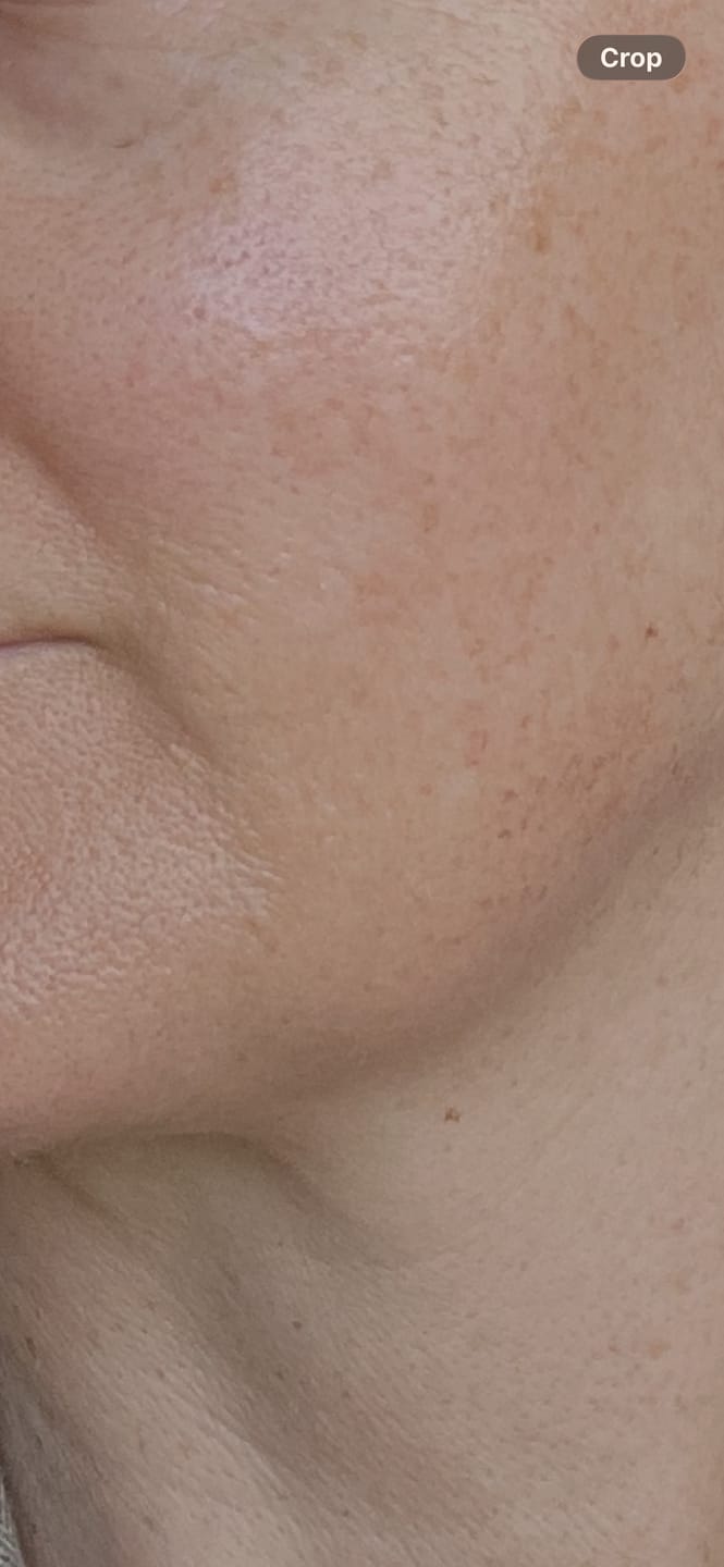 Customer photo review of Sea Cucumber Collagen Calming Cream