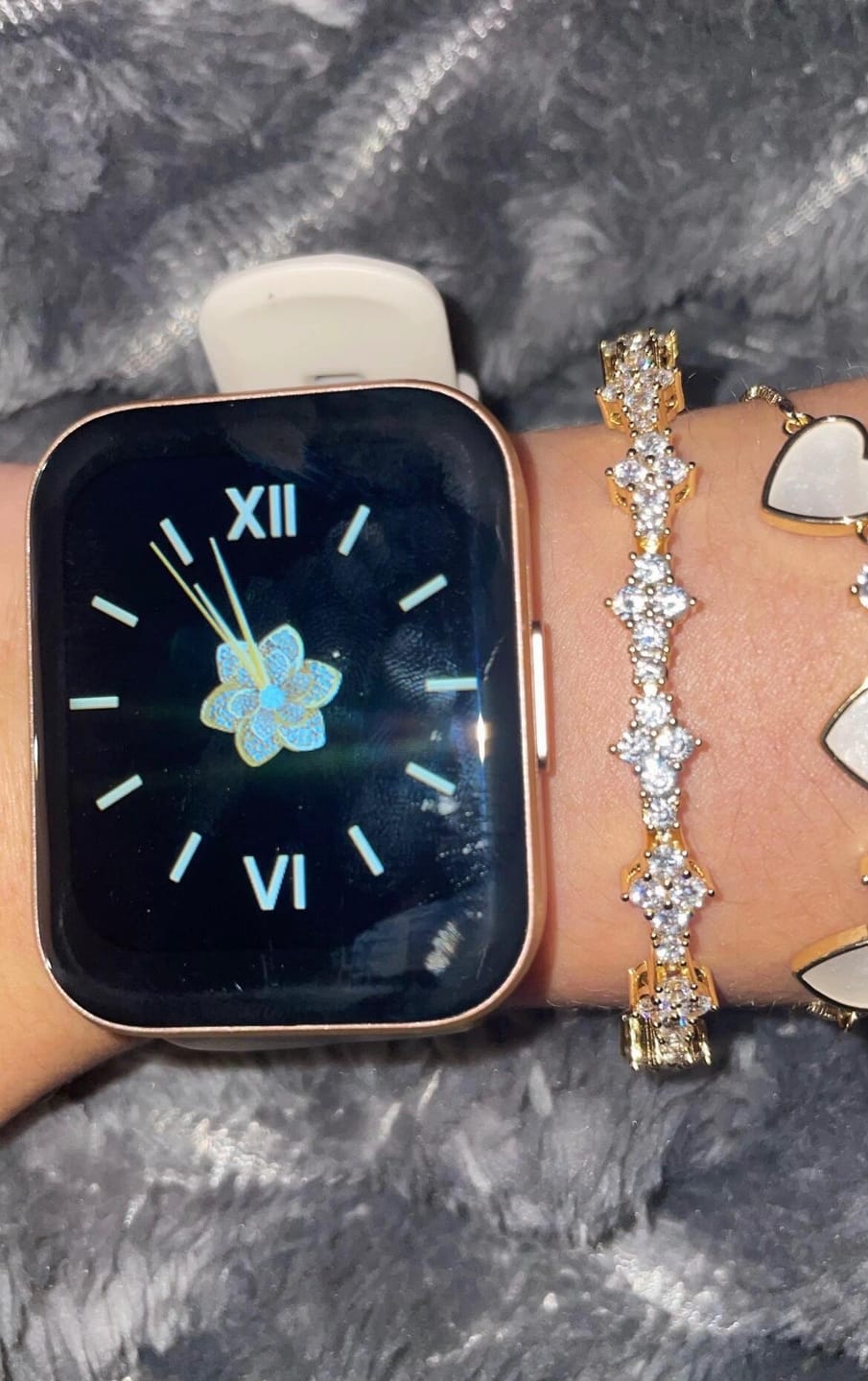 Customer photo review of Honeycomb Bracelets