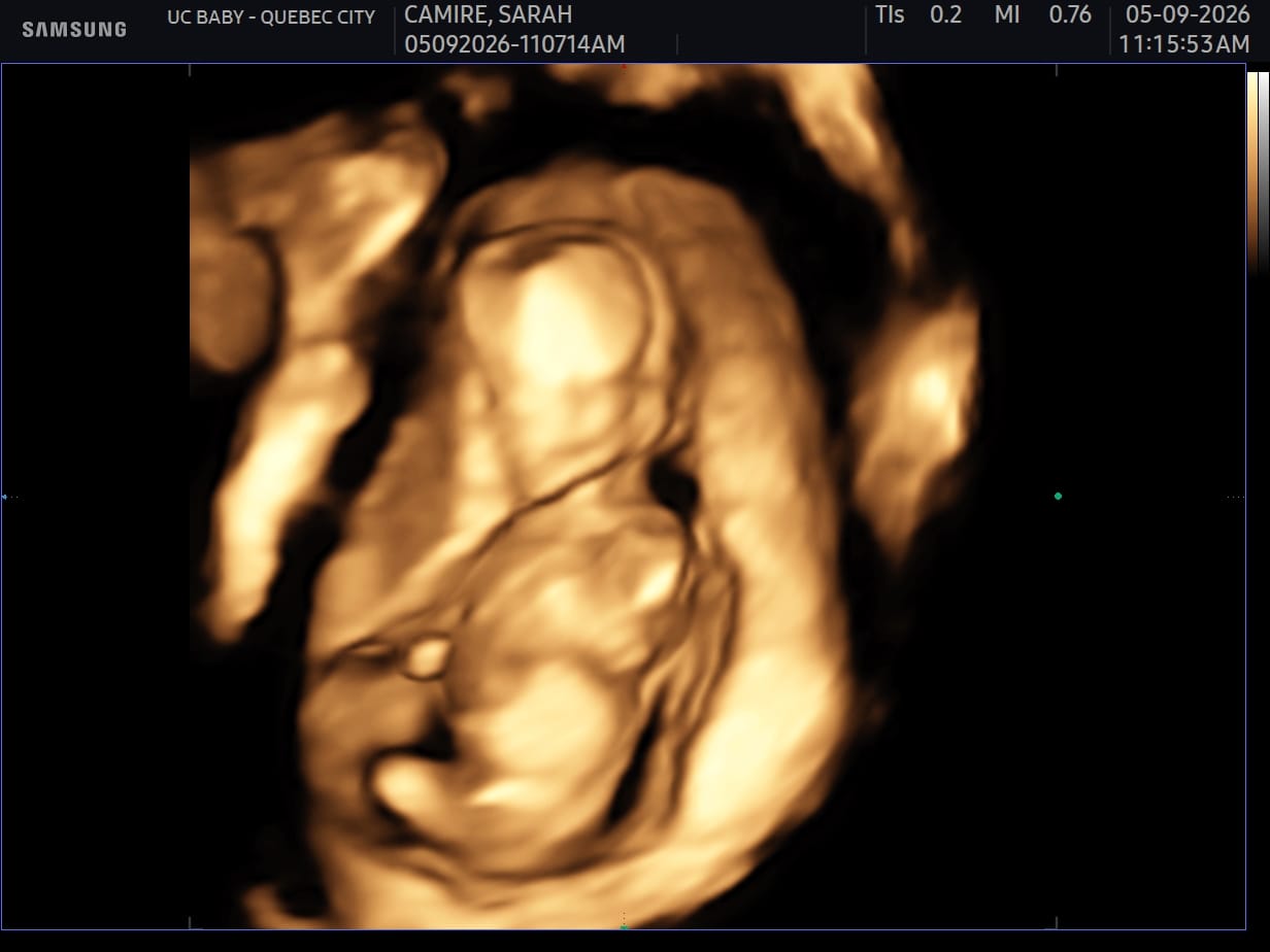 Customer photo review of EarlyReveal Tap DNA Gender Test Over 99% Accurate | Painless & Needle Free
