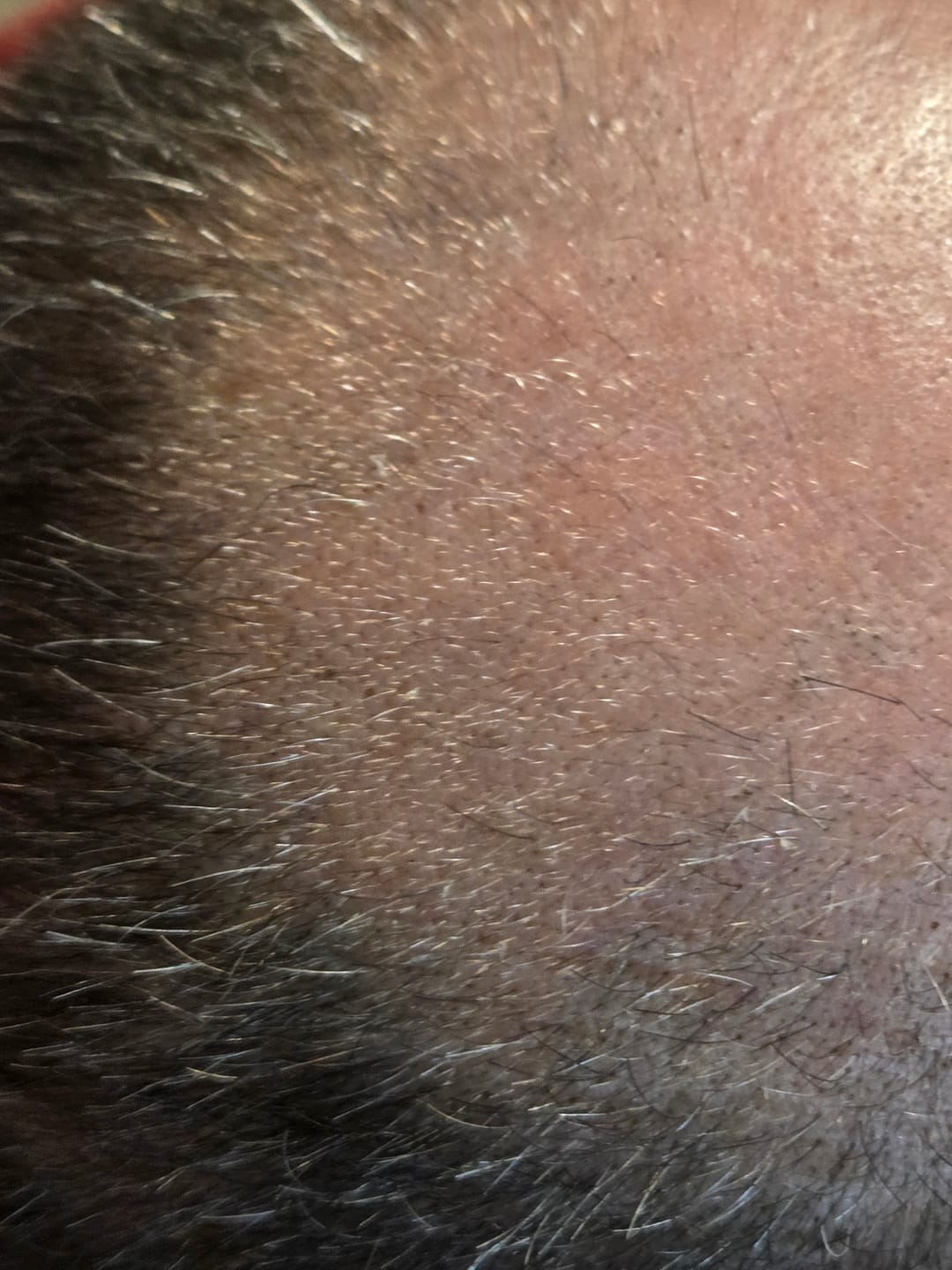 Customer photo review of Bloom: Hair Growth Oil