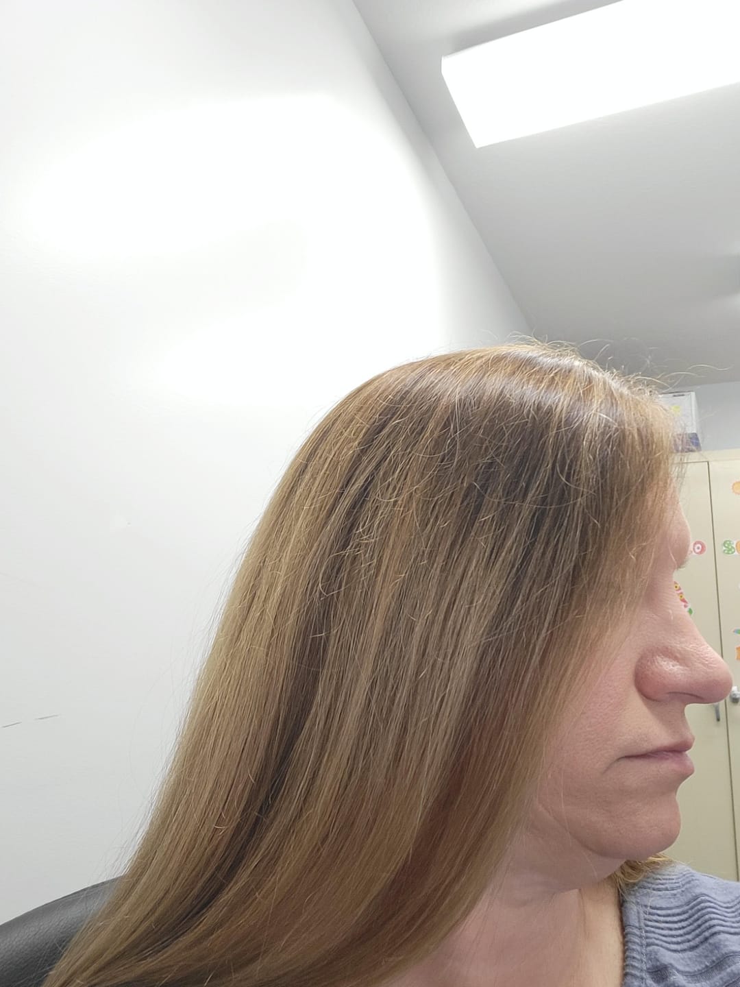 Customer photo review of Straight Hair Topper for Crown Thinning – Natural Coverage at the Crown