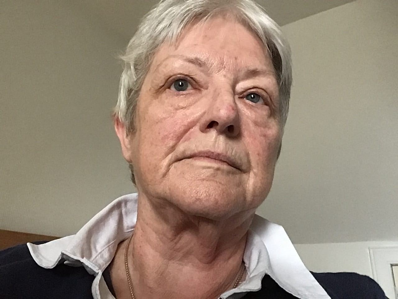 Customer photo review of Rosalique Soothing Night Cream