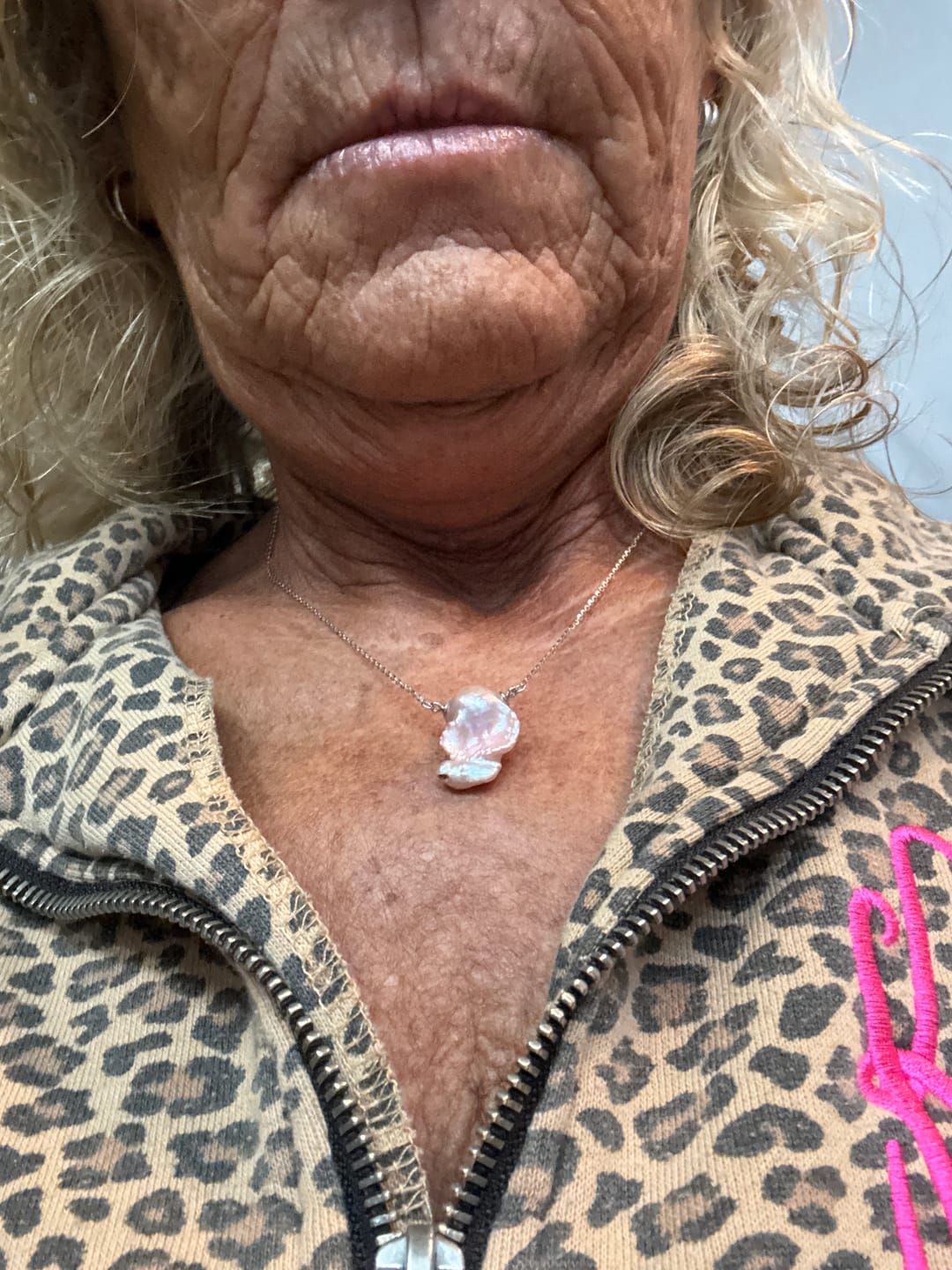Customer photo review of Akoya Oyster - Fireball Shaped Pearl