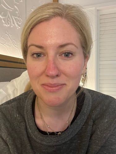 Customer photo review of Thriven NAD+ EGF Serum
