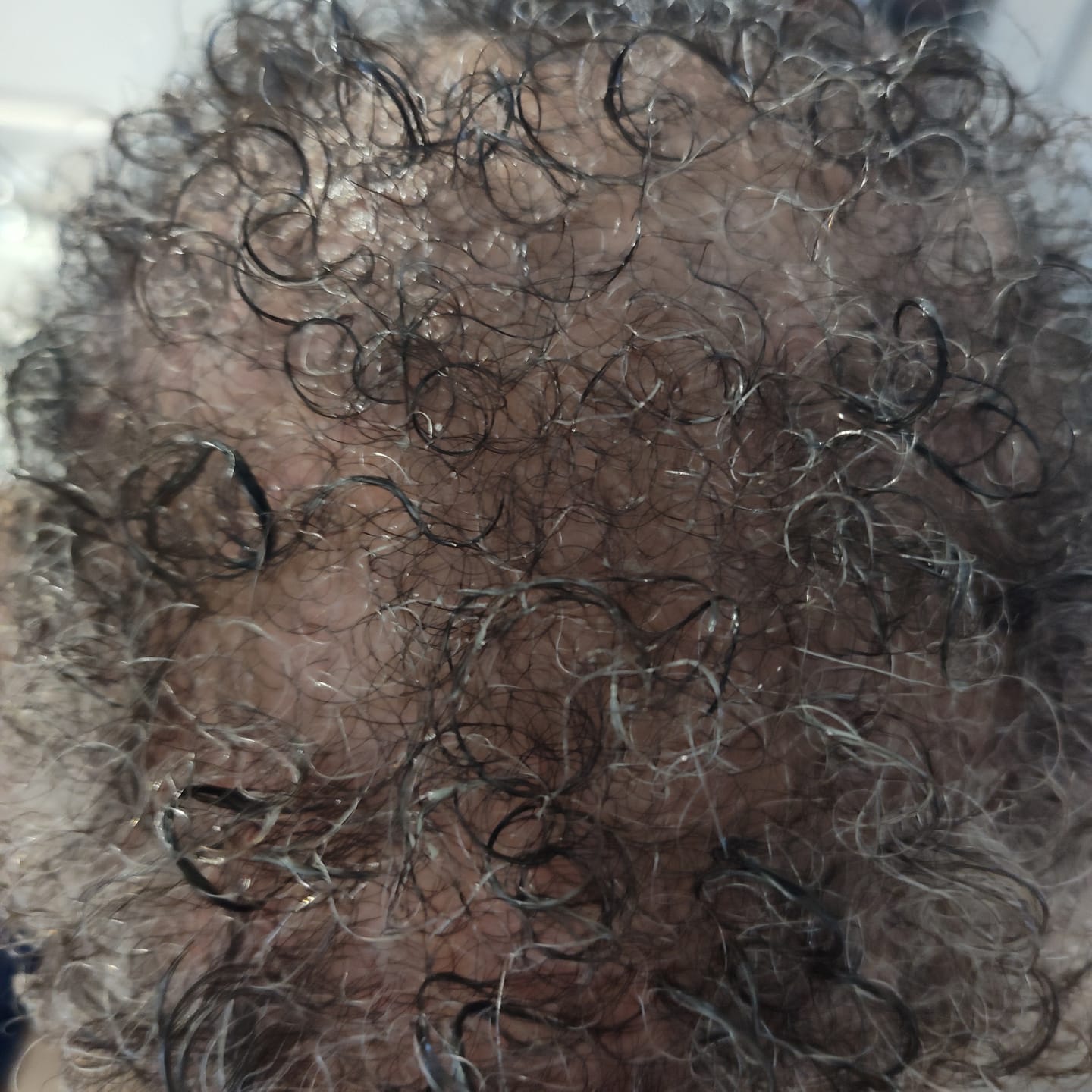 Customer photo review of Healthy Hair Starter Kit- Limited Edition