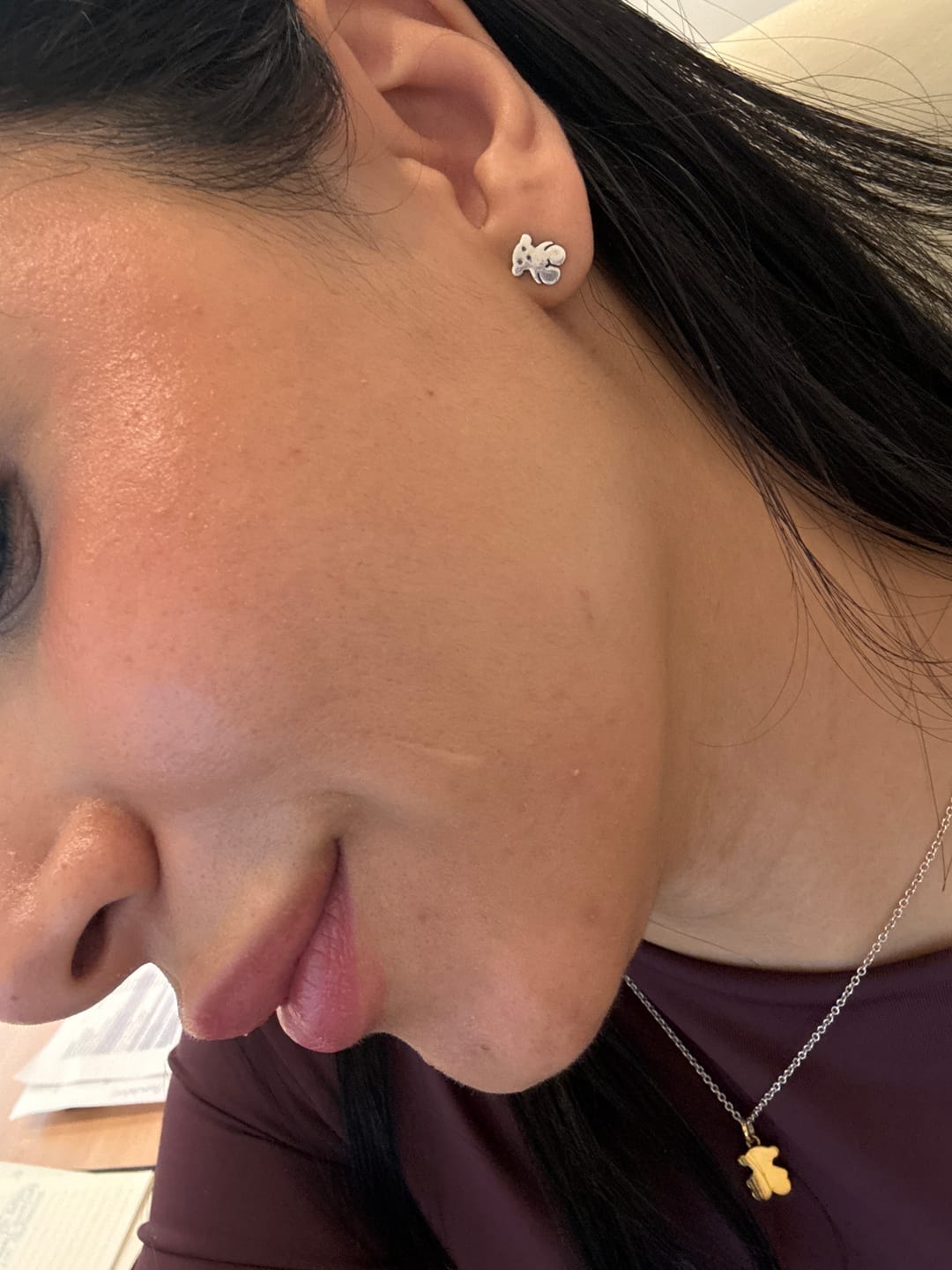 Customer photo review of A CONTROL - ACNÉ HORMONAL & RESISTENCIA A LA INSULINA
