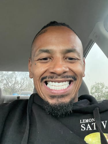 Customer smiling and showing their bright, white Pop On Veneers.