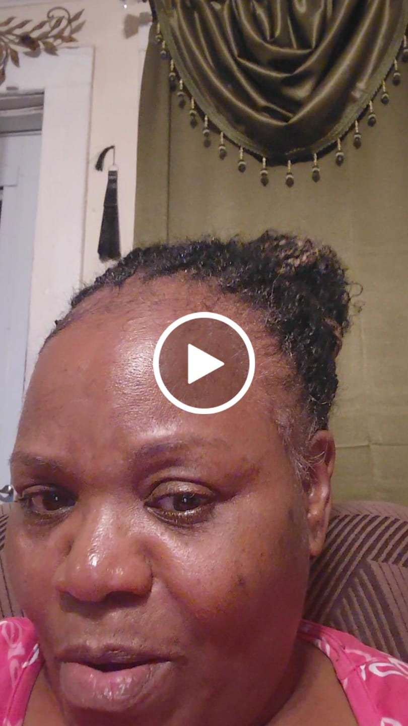 Customer video review of Protective Hairstyle & Edge Growth Bundle