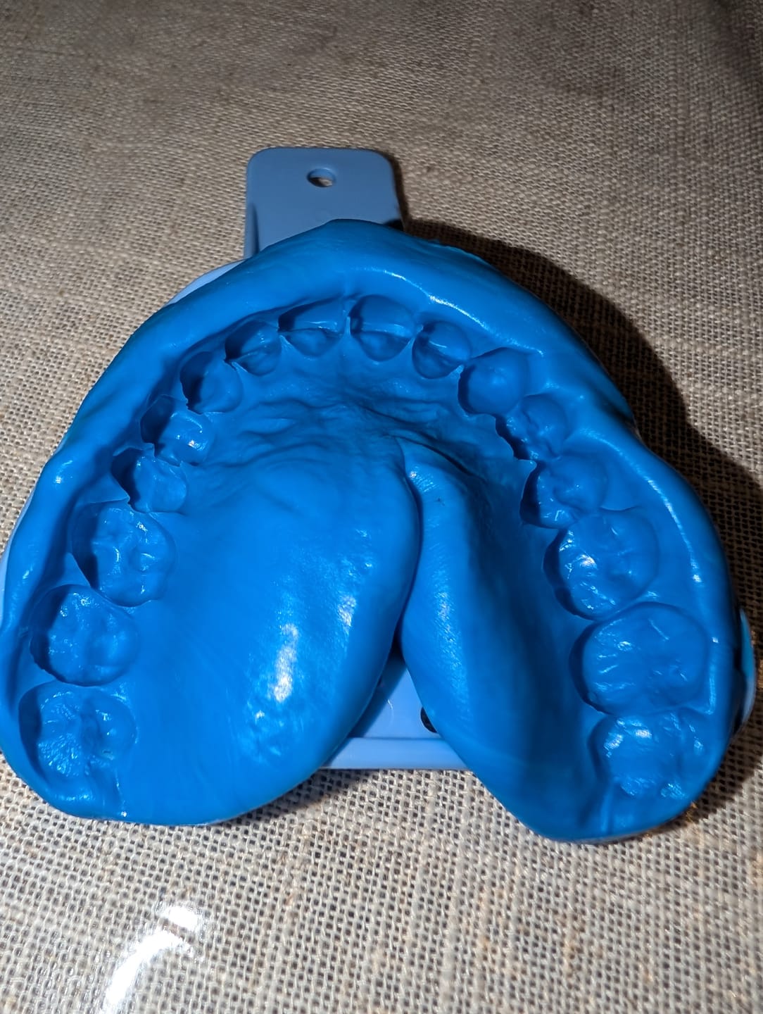 Customer photo review of Clear Custom Night Guard